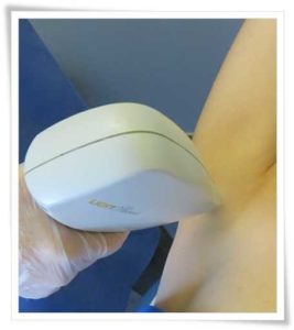 Trattamento Epilazione Laser